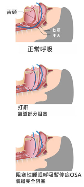 PSMAcpc睡眠監測暨亞健康監測